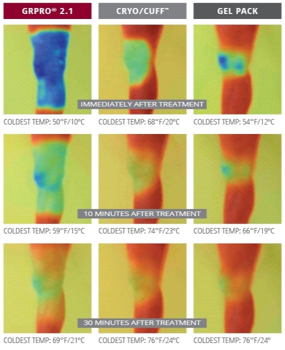 Thermal imaging comparing GRPro 2.1 with a cryo cuff and a gel pack over thirty minutes