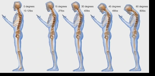 Diagram of the load on the cervical spine as the neck flexes forward