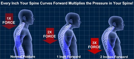 Diagram of spinal curvature under poor posture