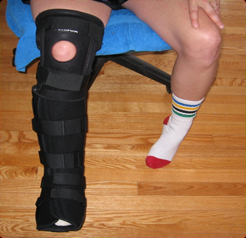 The Catalyst: a leg in a knee brace after injury